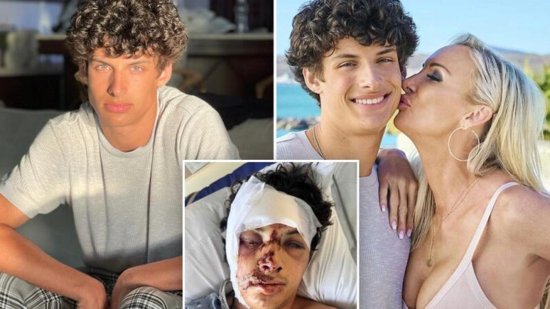 Joey Burford from ‘MILF Manor’ needs facial reconstruction surgery after horror accident