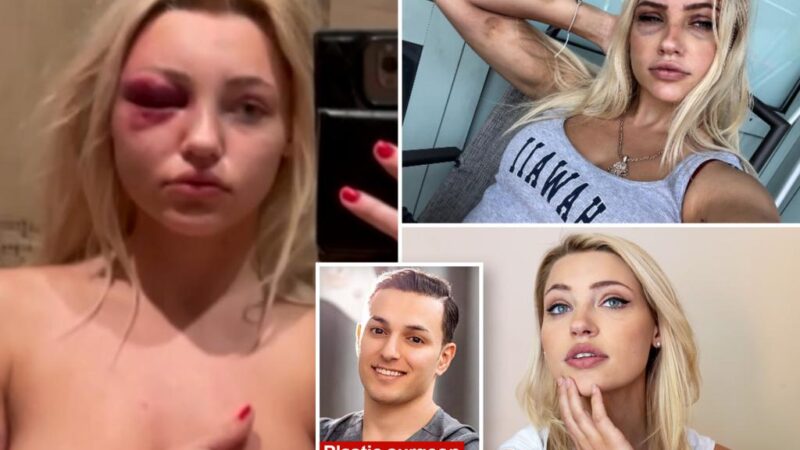 Model brutally beaten, turned into ‘sex slave’ by sicko NYC plastic surgeon who performed procedure without anesthetic to cover up abuse: lawsuit