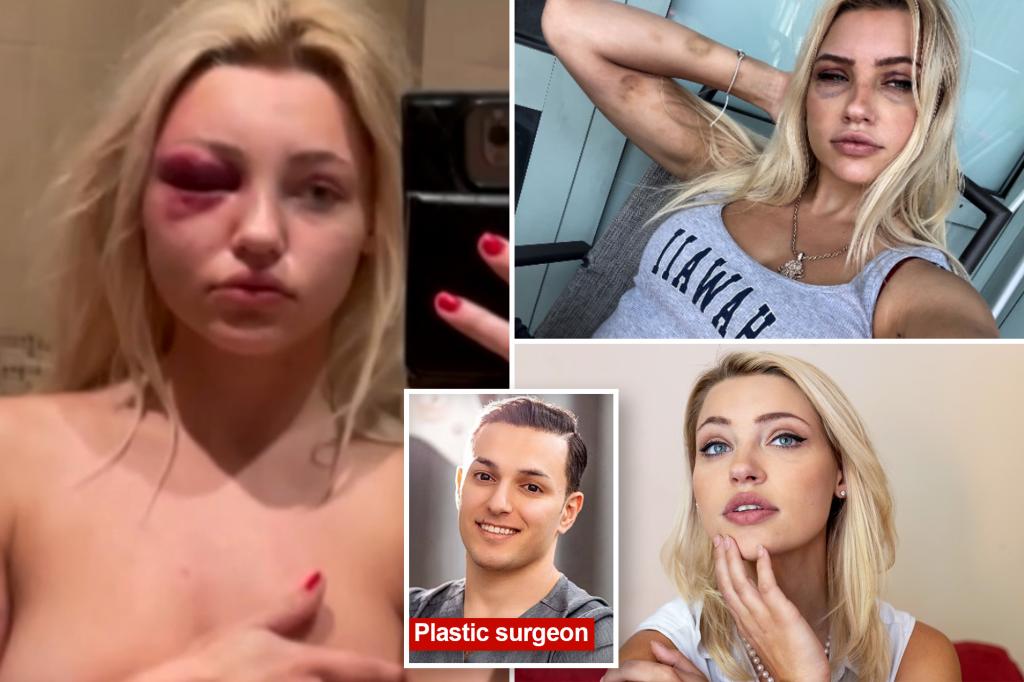 Model brutally beaten, turned into ‘sex slave’ by sicko NYC plastic surgeon who performed procedure without anesthetic to cover up abuse: lawsuit