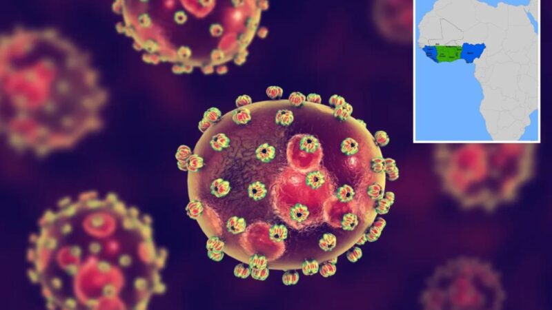 Iowa resident dies of suspected West African virus that can cause permanent hearing loss