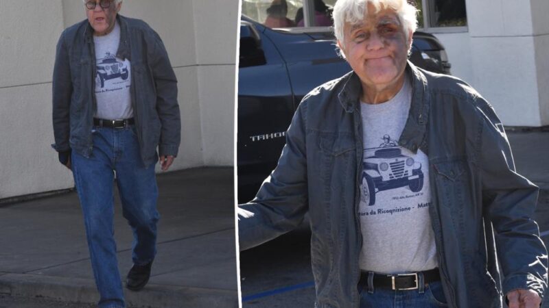 Jay Leno appears in good spirits despite massive nasty bruise from falling down a hill