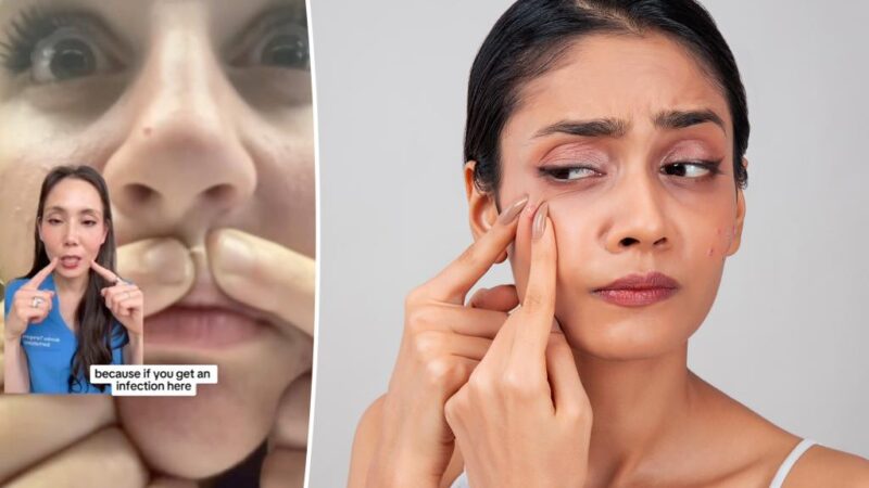 The best way to pop a pimple, according to a top dermatologist