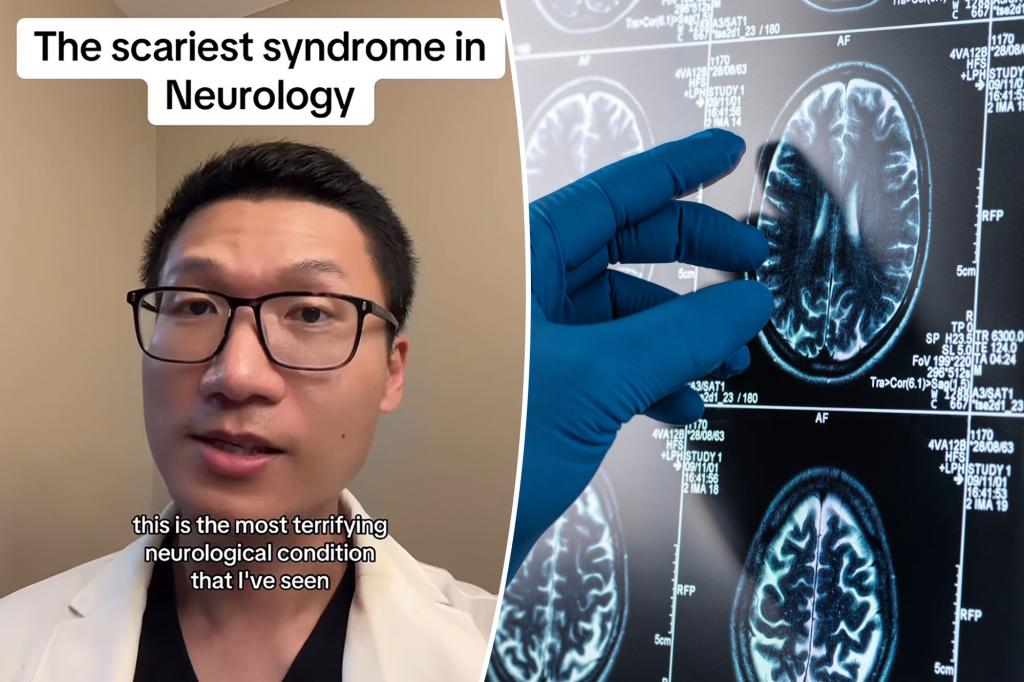 I’m a neurologist — the scariest condition I’ve ever seen