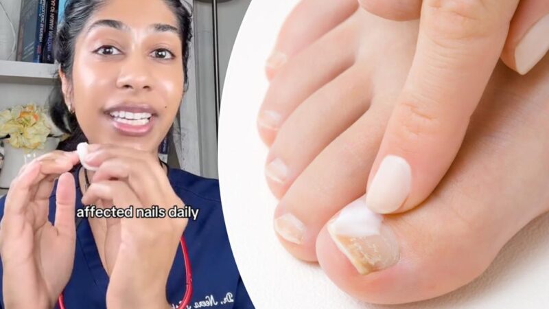 Cheap oral health staple can actually treat toenail fungus