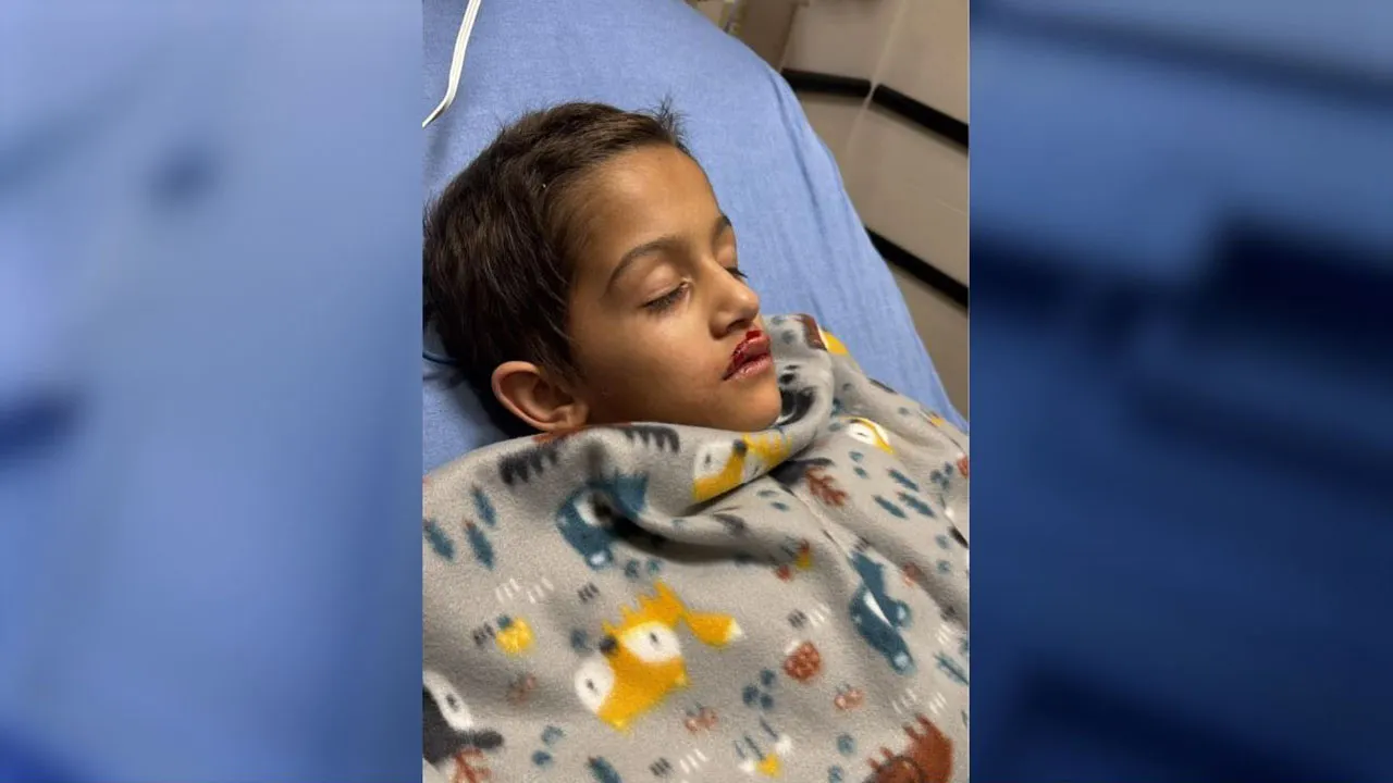 Florida boy has heart surgery after being struck by drone at holiday show