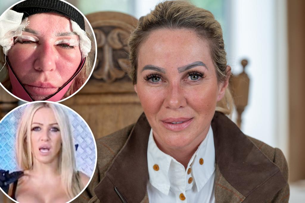 Former fashion model reverses $110K in cosmetic surgery