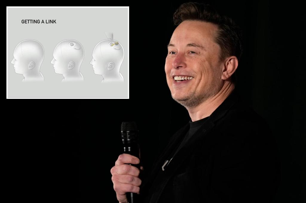 Elon Musk says third person gets Neuralink brain implant