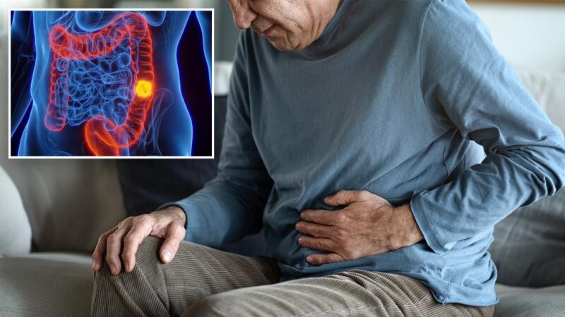 3 side effects from colorectal cancer people don’t talk about