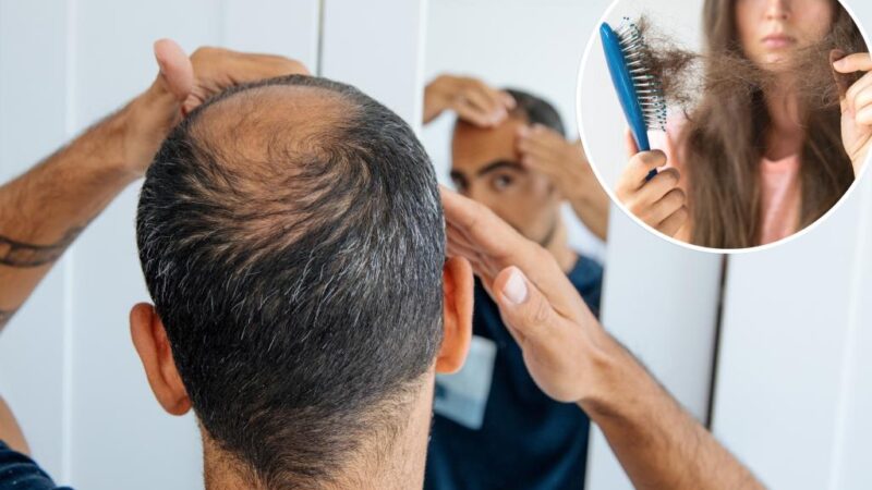 New hair loss treatment being tested with paid volunteers