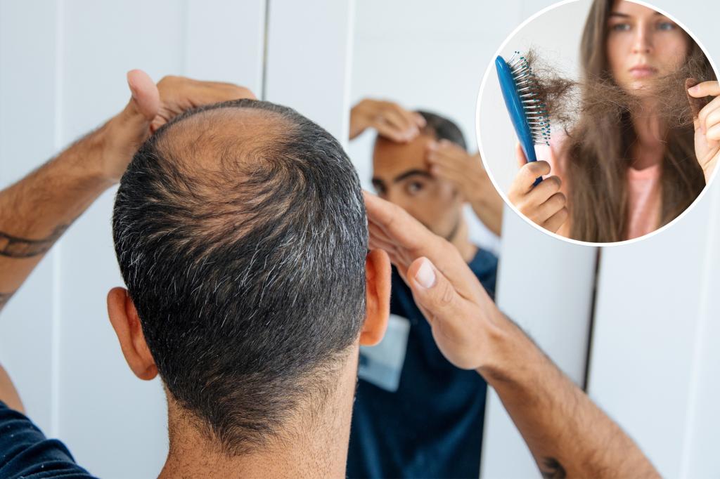 New hair loss treatment being tested with paid volunteers