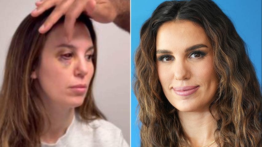 Christy Carlson Romano calls it a ‘miracle’ she isn’t blind after bullet came within a millimeter of her eye