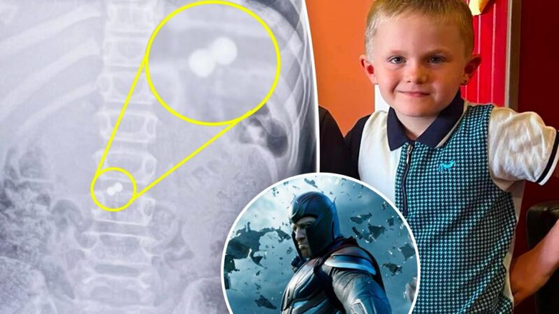 Boy swallows toy magnets, becomes X-Men’s Magneto in freak accident: ‘He burst out crying’